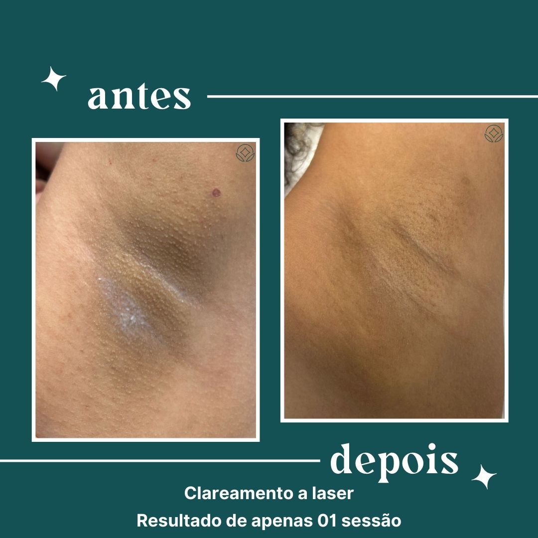 dipelle - para uso comercial (13)