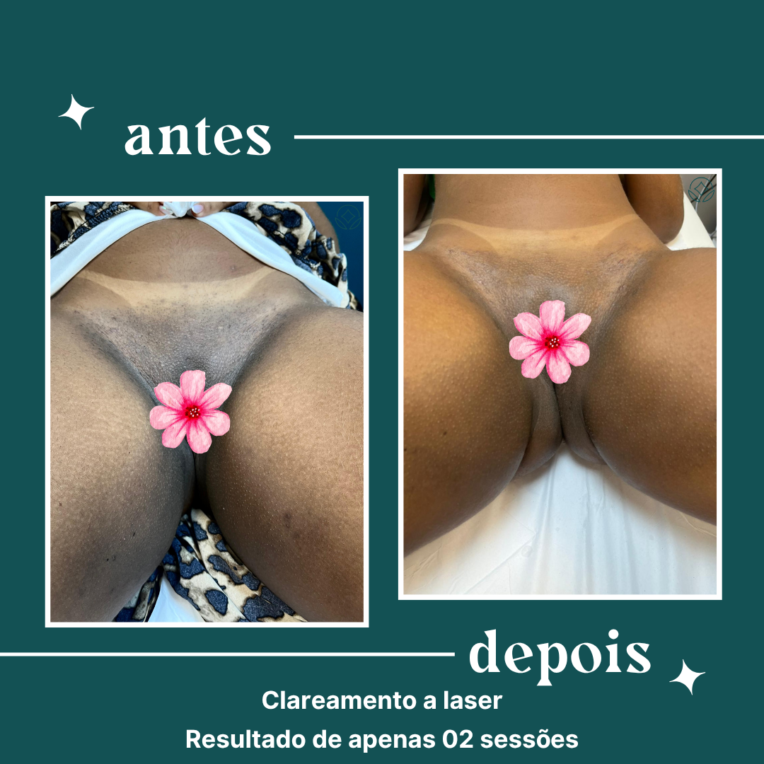 Cópia de definity copia uso comercial (1)