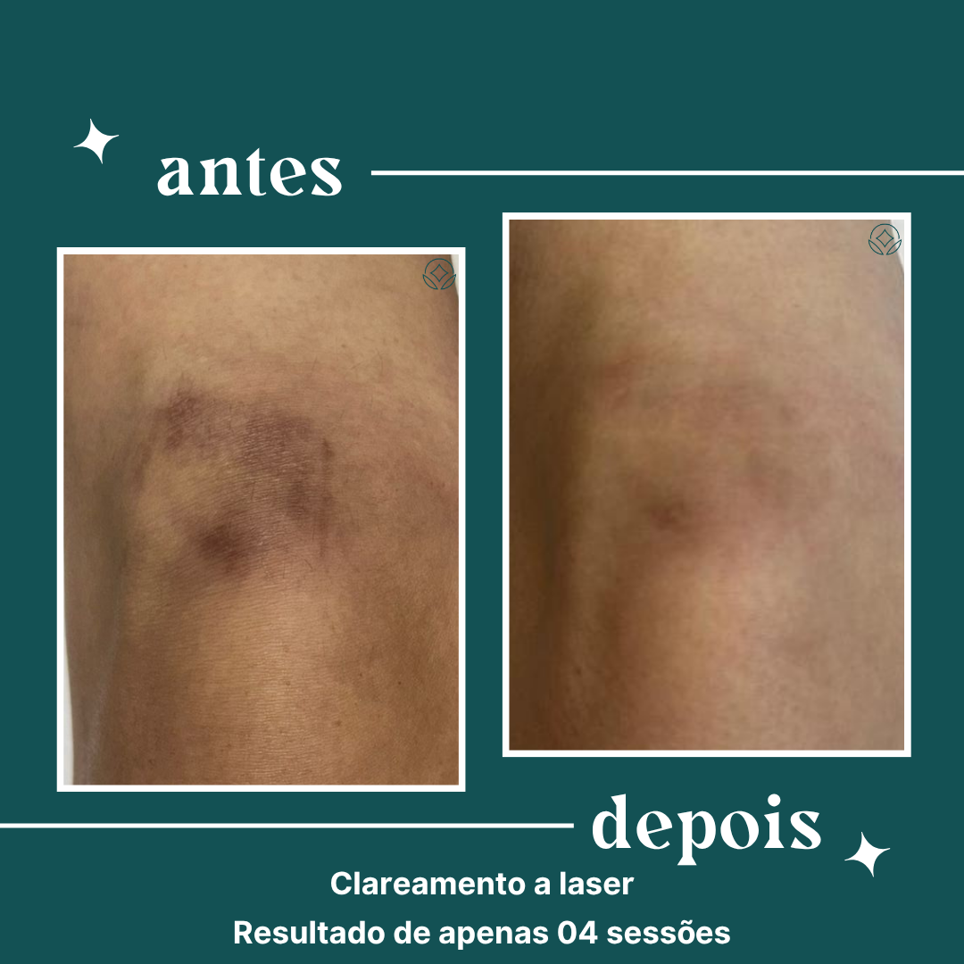 Cópia de definity copia uso comercial