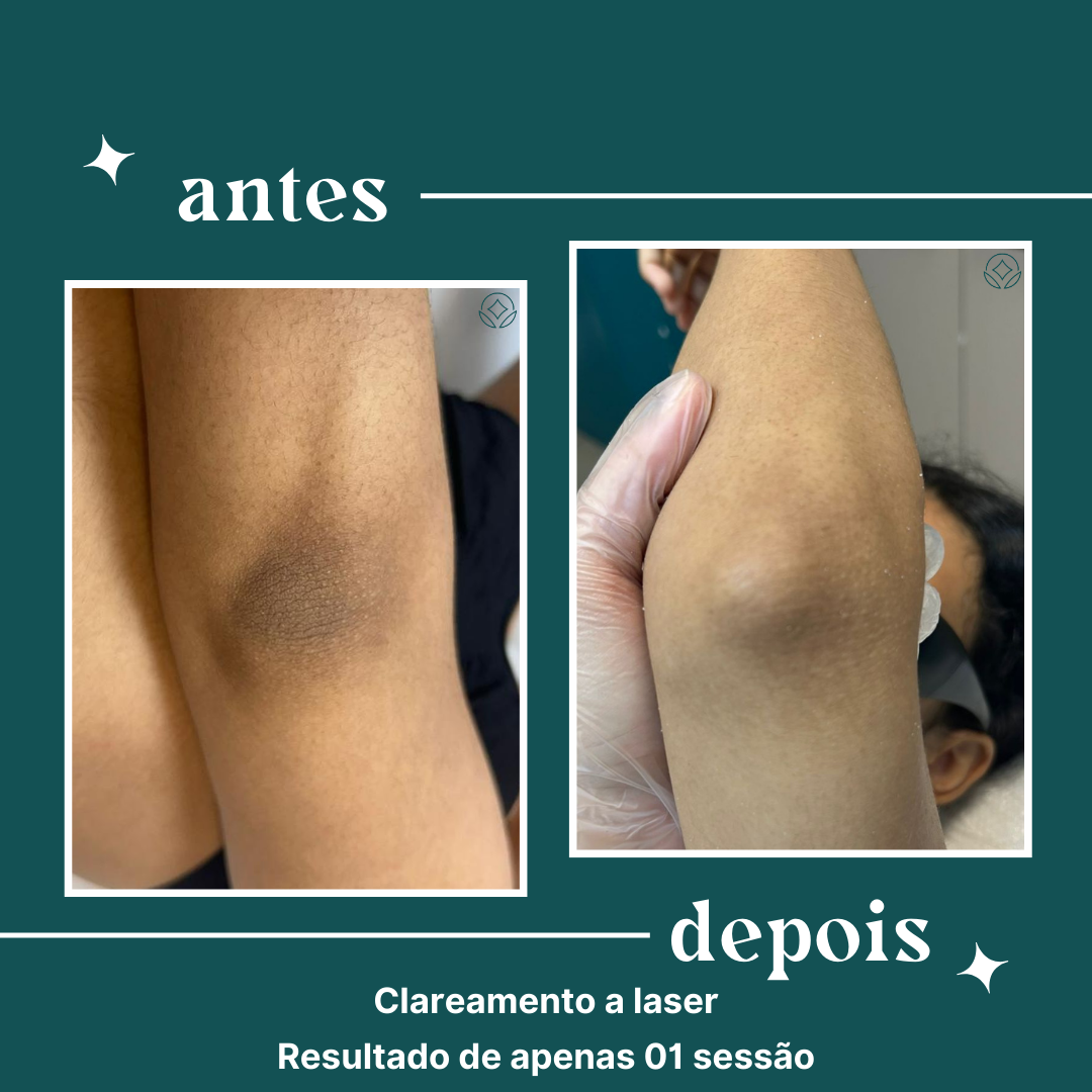 Cópia de definity copia uso comercial (11)