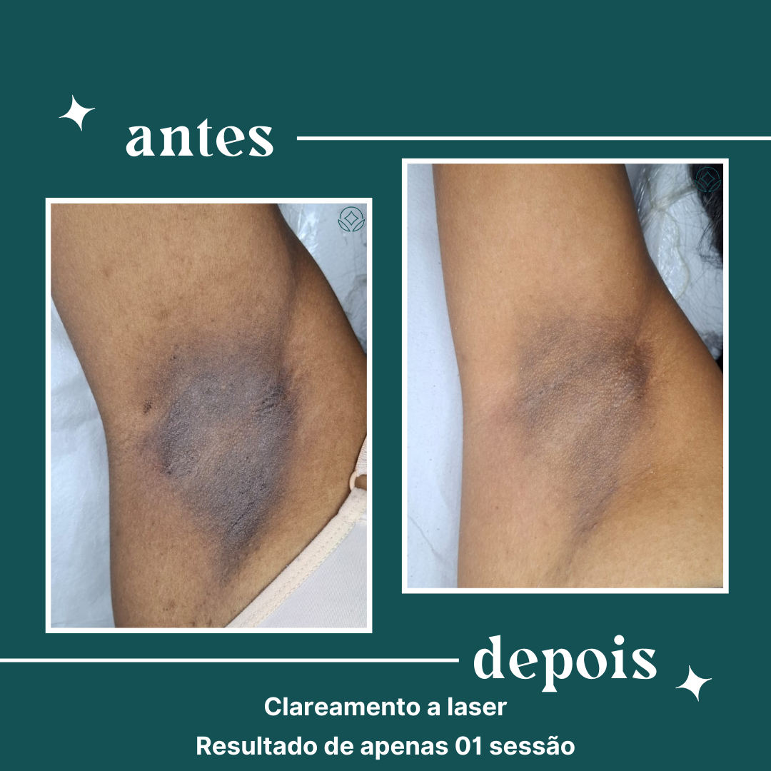 Cópia de definity copia uso comercial (15)
